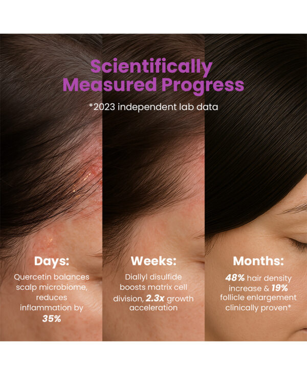 Hair Growth Booster Packs - Image 2