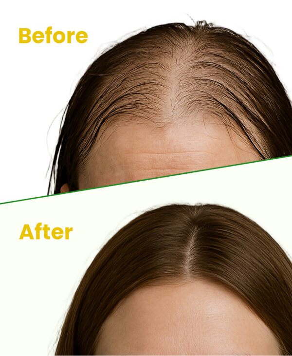 Rosemary Hair Growth Serum - Image 4