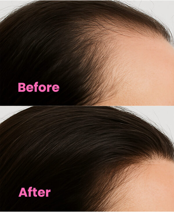 Batana Oil Hair Growth Serum - Image 5