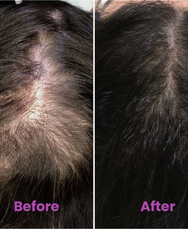 Onion Hair Growth Serum - Image 4